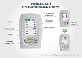 СКЭНАР-1-НТ (исполнение 01)  в Калуге купить Медицинская техника - denasosteo.ru 